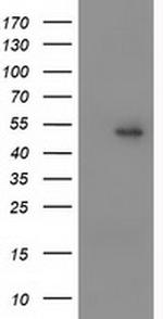 PPARA Antibody in Western Blot (WB)