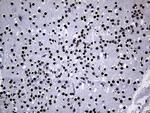 PPARD Antibody in Immunohistochemistry (Paraffin) (IHC (P))