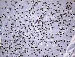 PPARD Antibody in Immunohistochemistry (Paraffin) (IHC (P))