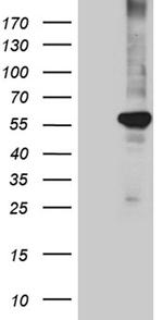 PPARD Antibody in Western Blot (WB)