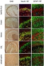 PPAR alpha Antibody in Immunocytochemistry, Immunohistochemistry (ICC/IF, IHC)