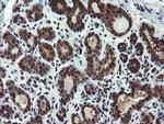 PPAT Antibody in Immunohistochemistry (Paraffin) (IHC (P))