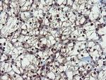 PPAT Antibody in Immunohistochemistry (Paraffin) (IHC (P))