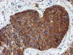 PPAT Antibody in Immunohistochemistry (Paraffin) (IHC (P))