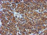 PPAT Antibody in Immunohistochemistry (Paraffin) (IHC (P))