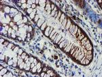 PPAT Antibody in Immunohistochemistry (Paraffin) (IHC (P))