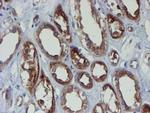 PPAT Antibody in Immunohistochemistry (Paraffin) (IHC (P))