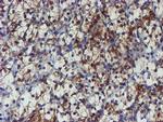 PPAT Antibody in Immunohistochemistry (Paraffin) (IHC (P))