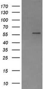 PPAT Antibody in Western Blot (WB)