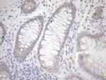 PPIF Antibody in Immunohistochemistry (Paraffin) (IHC (P))