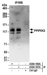 PPIP5K2 Antibody in Western Blot (WB)