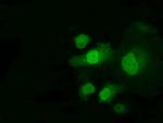 PPME1 Antibody in Immunocytochemistry (ICC/IF)