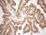 PPP1CA Antibody in Immunohistochemistry (Paraffin) (IHC (P))