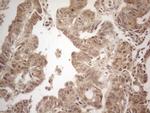 PPP1CA Antibody in Immunohistochemistry (Paraffin) (IHC (P))