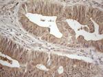 PPP1CA Antibody in Immunohistochemistry (Paraffin) (IHC (P))