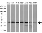 PPP1CA Antibody in Western Blot (WB)