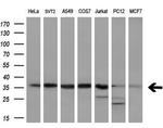 PPP1CA Antibody in Western Blot (WB)