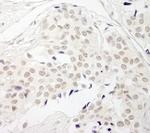 PPP1CB Antibody in Immunohistochemistry (IHC)