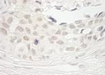 PPP1CB Antibody in Immunohistochemistry (IHC)