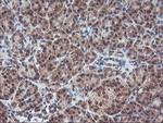 PPP1R15A Antibody in Immunohistochemistry (Paraffin) (IHC (P))