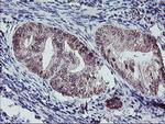 PPP1R15A Antibody in Immunohistochemistry (Paraffin) (IHC (P))