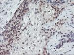 PPP1R15A Antibody in Immunohistochemistry (Paraffin) (IHC (P))