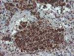 PPP1R15A Antibody in Immunohistochemistry (Paraffin) (IHC (P))