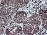 PPP1R15A Antibody in Immunohistochemistry (Paraffin) (IHC (P))