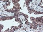 PPP1R15A Antibody in Immunohistochemistry (Paraffin) (IHC (P))