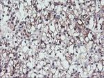 PPP1R15A Antibody in Immunohistochemistry (Paraffin) (IHC (P))