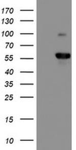 PPP1R15A Antibody in Western Blot (WB)