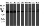 PPP1R15A Antibody in Western Blot (WB)