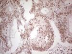 PPP1R8 Antibody in Immunohistochemistry (Paraffin) (IHC (P))