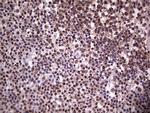 PPP1R8 Antibody in Immunohistochemistry (Paraffin) (IHC (P))