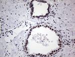 PPP1R8 Antibody in Immunohistochemistry (Paraffin) (IHC (P))