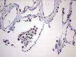 PPP1R8 Antibody in Immunohistochemistry (Paraffin) (IHC (P))