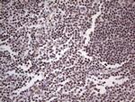 PPP1R8 Antibody in Immunohistochemistry (Paraffin) (IHC (P))