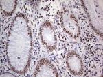 PPP1R8 Antibody in Immunohistochemistry (Paraffin) (IHC (P))