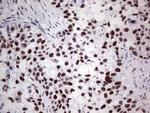 PPP1R8 Antibody in Immunohistochemistry (Paraffin) (IHC (P))