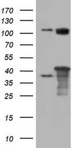 PPP1R8 Antibody in Western Blot (WB)