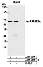 PPP2R1A Antibody in Immunoprecipitation (IP)