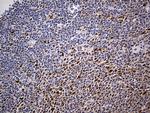 PPP2R1B Antibody in Immunohistochemistry (Paraffin) (IHC (P))