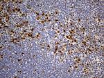 PPP2R1B Antibody in Immunohistochemistry (Paraffin) (IHC (P))