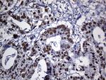 PPP2R1B Antibody in Immunohistochemistry (Paraffin) (IHC (P))