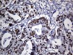 PPP2R1B Antibody in Immunohistochemistry (Paraffin) (IHC (P))