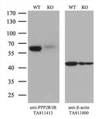 PPP2R1B Antibody in Western Blot (WB)