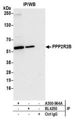 PPP2R2B Antibody in Western Blot (WB)