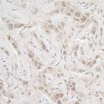 PPP3CA Antibody in Immunohistochemistry (IHC)