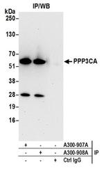 PPP3CA Antibody in Western Blot (WB)