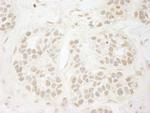 PPP3CA Antibody in Immunohistochemistry (IHC)